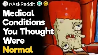 Medical Conditions You Thought Were Normal
