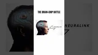 The Brain-Chip Battle | Synchron vs Neuralink #technology #tech #conversationworthy