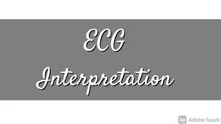 ECG INTERPRETATION | A SYSTEMATIC APPROACH | BASICS OF ECG