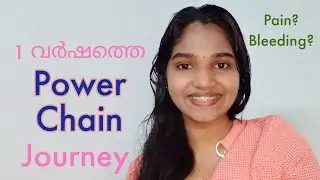 🦷🔥എന്റെ ഒരു വർഷത്തെ Power Chain Story | Pain |Bleeding | Braces