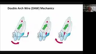 🙌 The video explains how the double wire arc method works.