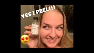 Esthetician Peel Your Way to Success! Professional Peel Glycolic Lactic Mandelic