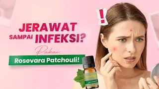 Patchouli Untuk Atasi Infeksi Jerawat || Essential Oil Rosevara