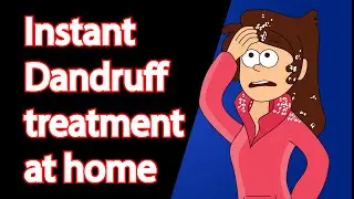How to get rid of Dandruff quickly -Part 2 | Instant Dandruff treatment at home | 2021