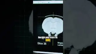 Маск: Возможно ли движение всем телом? 🤯
