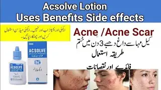 Acsolve lotion /gel for acne and acne scar l acsolve gel Review
