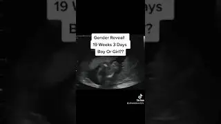 Gender Reveal Ultrasound at 19 weeks 3 days pregnant
