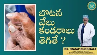 ✨ Tendon Transfer Surgery by Dr. Pratap Duggirala | Best Plastic Surgeon in Vijayawada!