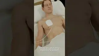 Why Transcutaneous Pacing Saves Lives in Seconds (3D Visual)
