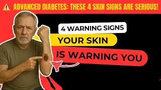 URGENT! 4 Skin Signs Indicating Advanced Diabetes in Over-60s (The 3rd is Fatal)