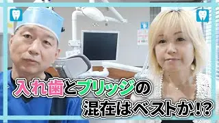 入れ歯とブリッジの混在はベストか！？