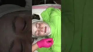 Age Management DMK Treatment #wrinklefreeskin #agemanagement #antiaging #wrinkletreatment #facial