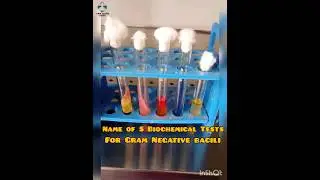 5 Biochemical test | Identification of Bacteria | GNB #bacteriology #Microbiology