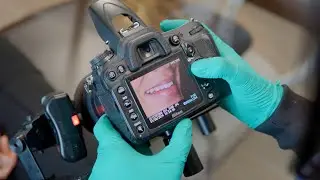 Tooth Colored Fillings with Chesapeake Center for Complete Dentistry (Chesapeake VA Dentist)