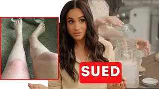 Meghan Markle SUED for $10 MILLION: Her Bath Salt Recipe Causes HORRIFYING Skin BURNS!