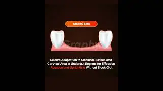 Essence of Shape Memory Aligner (3)