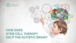 How Does Stem Cell Therapy Help The Autistic Brain? #Autism #stemcelltherapy #Stemcells