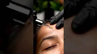 Patient 97 | Ultra Satisfying Close Up #asmr #satisfying #relaxing #closeup #skincare #visualasmr