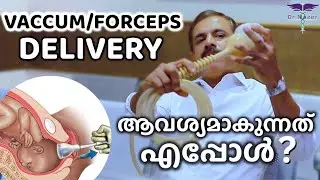 VACCUM & FORCEPS DELIVERY | MALAYALAM | VACCUM ഡെലിവറി ആവശ്യമാകുന്നത് എപ്പോൾ ? | Dr NAZER