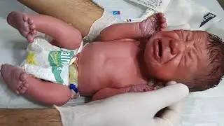 Newborn Baby IV Line Management | Medication Administration & Emergency Care