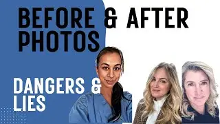 Should You Trust Before & After Photos in Plastic Surgery? | The Truth About Images & AI