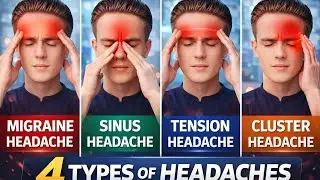 Types of Headaches Explained | Migraine, Sinus, Tension & Cluster Headache