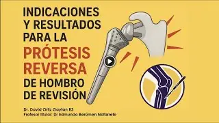 Indicaciones y resultados para la prótesis reversa de hombro de revision