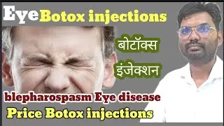 botox injections in eye / botulinum toxin hindi / बोटुलिनम टॉक्सिन / बोटॉक्स इंजेक्शन /blepharospasm