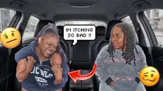 ITCHING POWDER PRANK ON FIANC&Eacute;E 🥴