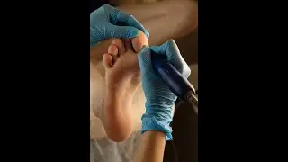 ✅ Top 5:🦶🦶 Best Electric Callus Remover [ Best Way To Remove Callus From Feet ]  #viral #shorts