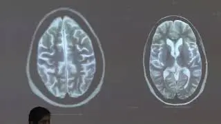 Clinical Case Discussions 17 12 2025 Dr.pinnamaneni SIMS &RF