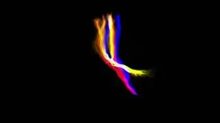 Interactive Stereotactic Phantom