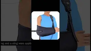 Вот как лечат сломанные плечи #3DMedical #Хирургия