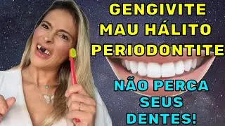 GENGIVITE, MAU HÁLITO, PERIODONTITE! COMO TRATAR DE FORMA SIMPLES E NÃO PERDER OS DENTES!