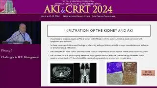 Don't You Forget About Me- Non-ATN Causes of AKI in the ICU