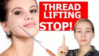 THREADS FOR FACE LIFT. What complications of thread lifting can be. MEZOTHREADS