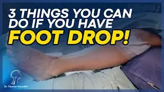 Foot Drop Surgery: When is it Done, What are the Indications? Restoring Foot Mobility!!