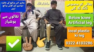 Below Knee Artificial leg total plastic  with imported foot and imported cap #ottobock #leg #limb