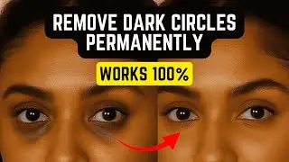 Get Rid Of Dark Circles Overnight | Super Powerful Subliminal Audio (Permanent Results)