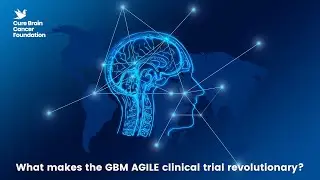 What makes the GBM AGILE trial revolutionary?