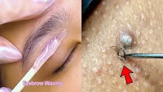Most Extreme Beauty Treatments 2024 Best Smart and Helpful Beauty Hacks | Virtual Beauty
