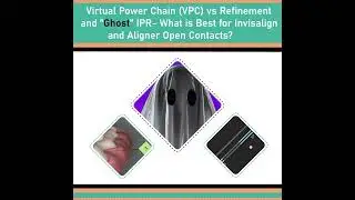 Open Aligner Inter-proximal Contacts at Finish- VPC vs Ghost IPR