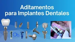 Aditamentos para Implantes Dentales