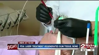 NBC TULSA LANAP Dr mccormick