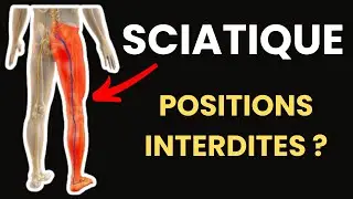 Sciatique : Y a-t-il Vraiment des Positions à Éviter ?