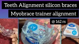 Teeth alignment silicon braces @162 rs l myobrace trainer alignment l teeth straighten#retainer