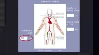 Training Video: Setting up SphygmoCor XCEL Version 1.3