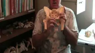 Symphyseal Diastasis AKA Pubic Joint Rupture PART 1