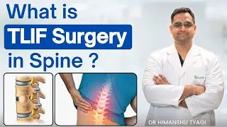 What is TLIF surgery in spine ? | Transforaminal Lumbar Interbody Fusion in Spine