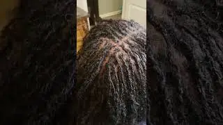 Microlock Retie